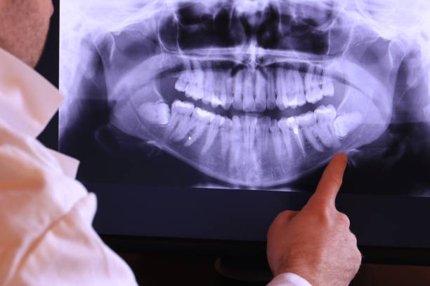 Best Emergency Broken Tooth Repair in Elmo, TX